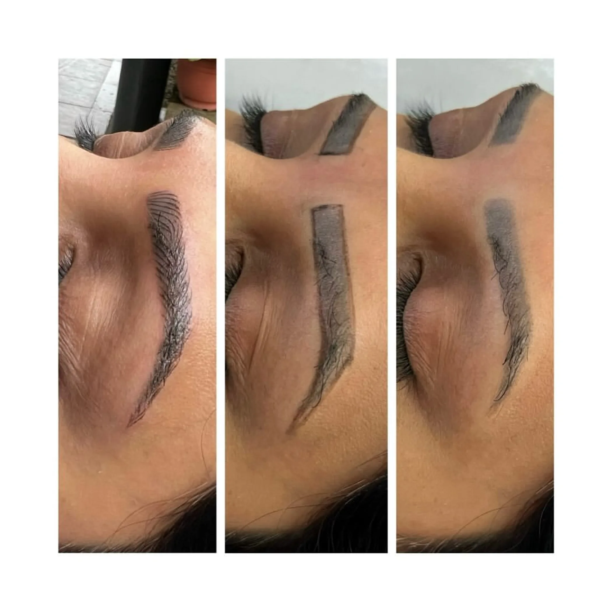 cosmetic tattooed eyebrows